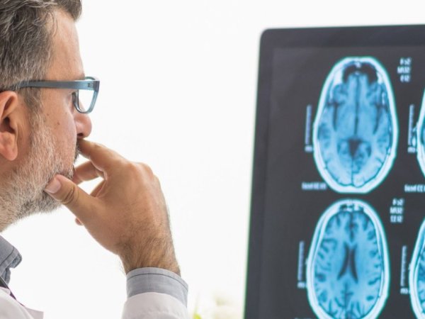 Un especialista de neurología analizando resultados de imagenología cerebral de un paciente.